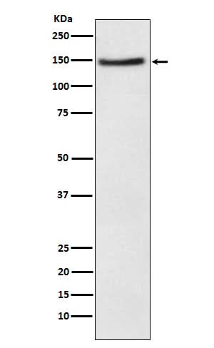 Anti-NPC1L1 Rabbit Monoclonal Antibody Boster Bio