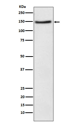 Anti-NPC1L1 Rabbit Monoclonal Antibody Boster Bio