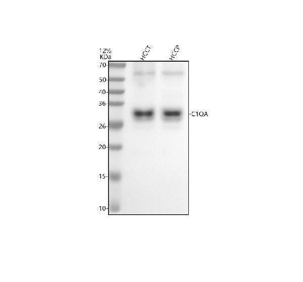 Anti-C1QA Rabbit Monoclonal Antibody Boster Bio