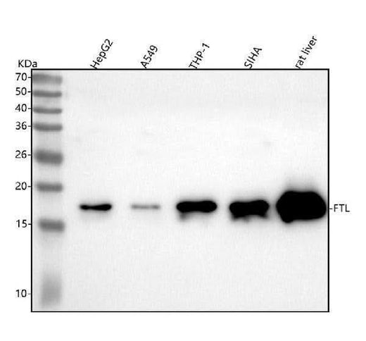 Anti-Ferritin Light Chain FTL Monoclonal Antibody Boster Bio