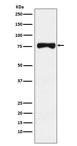 Anti-TRP1 Monoclonal Antibody Boster Bio