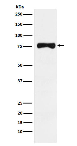 Anti-TRP1 Monoclonal Antibody Boster Bio