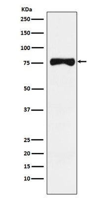 Anti-TRP1 Monoclonal Antibody Boster Bio