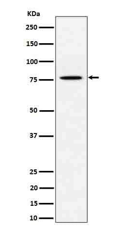 Anti-PSIP1 / LEDGF Rabbit Monoclonal Antibody Boster Bio