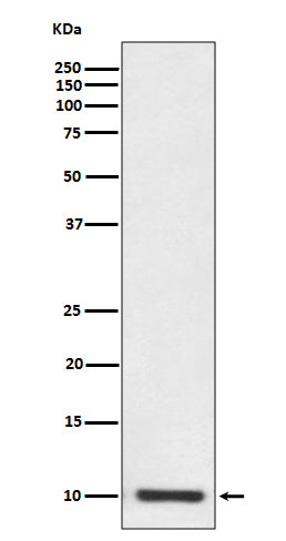 Anti-S100P Rabbit Monoclonal Antibody Boster Bio