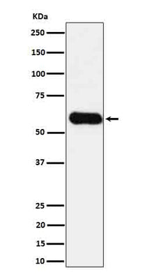 Anti-CD275 Rabbit Monoclonal Antibody Boster Bio