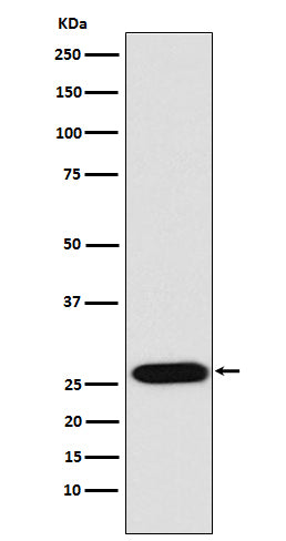 Anti-LIN28 LIN28A Monoclonal Antibody Boster Bio