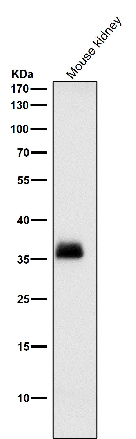 Anti-SFRP1 Rabbit Monoclonal Antibody Boster Bio
