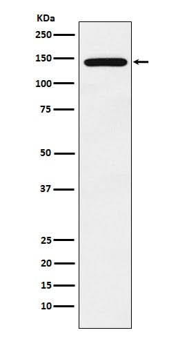 Anti-Jarid2 Rabbit Monoclonal Antibody Boster Bio