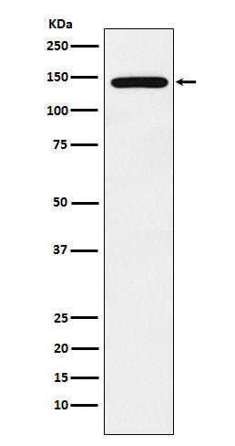 Anti-Jarid2 Rabbit Monoclonal Antibody Boster Bio