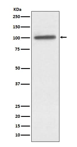 Anti-alpha Actinin 4 ACTN4 Monoclonal Antibody Boster Bio