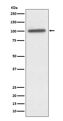 Anti-alpha Actinin 4 ACTN4 Monoclonal Antibody Boster Bio