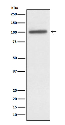 Anti-alpha Actinin 4 ACTN4 Monoclonal Antibody Boster Bio