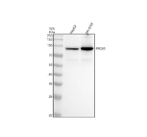 Anti-PROX1 Rabbit Monoclonal Antibody Boster Bio