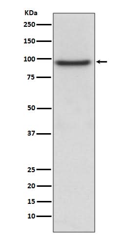 Anti-PROX1 Rabbit Monoclonal Antibody Boster Bio