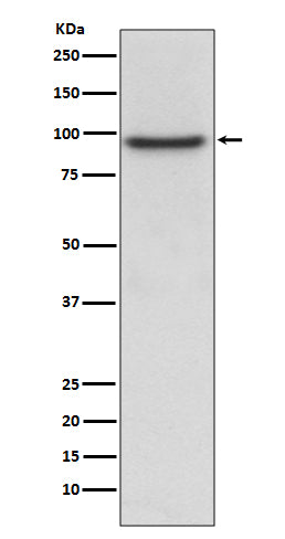 Anti-PROX1 Rabbit Monoclonal Antibody Boster Bio