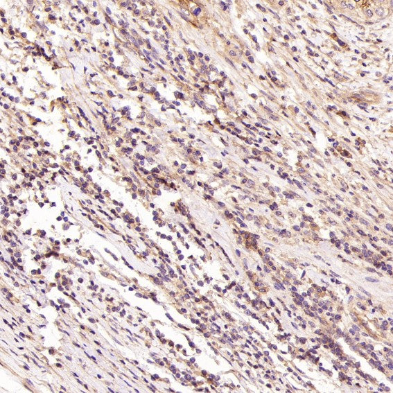 Anti-H Cadherin Rabbit Monoclonal Antibody Boster Bio