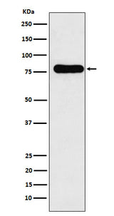 Anti-GAB1 Monoclonal Antibody Boster Bio