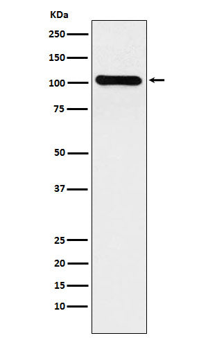 Anti-BACH1/BRIP1 Rabbit Monoclonal Antibody Boster Bio