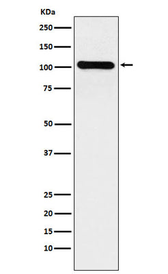 Anti-BACH1/BRIP1 Rabbit Monoclonal Antibody Boster Bio