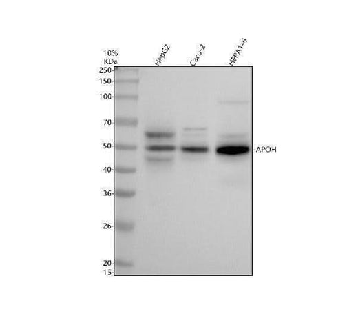 Anti-ApoH Rabbit Monoclonal Antibody Boster Bio
