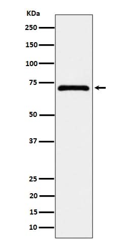Anti-EPHX2 Rabbit Monoclonal Antibody Boster Bio