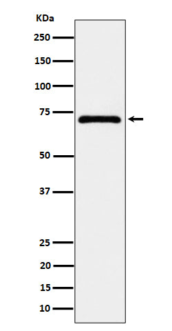 Anti-EPHX2 Rabbit Monoclonal Antibody Boster Bio