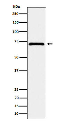 Anti-EPHX2 Rabbit Monoclonal Antibody Boster Bio