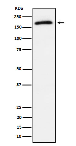 Anti-Phospho-AS160 (T642) Rabbit Monoclonal Antibody Boster Bio