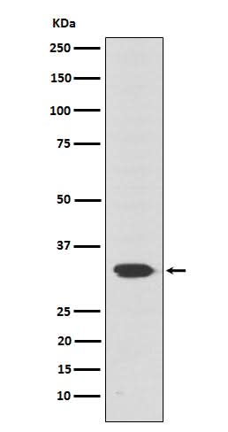 Anti-Otx2 Rabbit Monoclonal Antibody Boster Bio