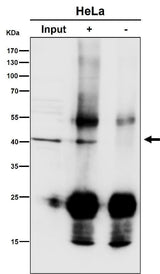 Anti-ACAT1 Rabbit Monoclonal Antibody Boster Bio