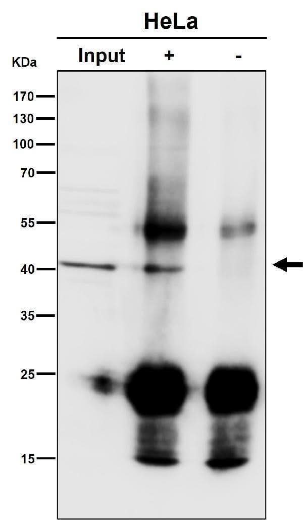 Anti-ACAT1 Rabbit Monoclonal Antibody Boster Bio