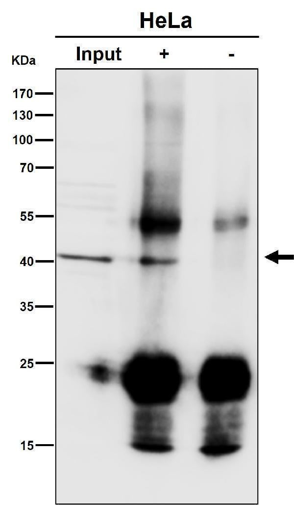 Anti-ACAT1 Rabbit Monoclonal Antibody Boster Bio