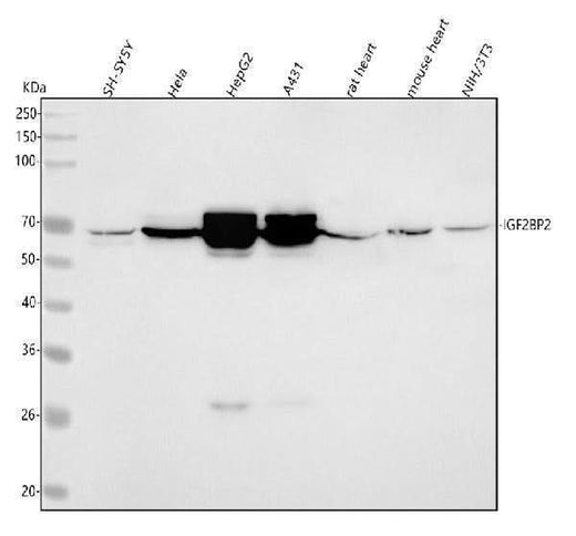 Anti-IMP2 Rabbit Monoclonal Antibody Boster Bio