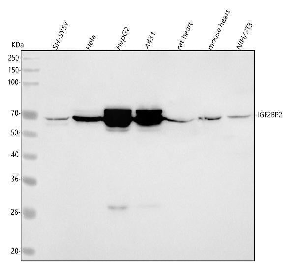 Anti-IMP2 Rabbit Monoclonal Antibody Boster Bio
