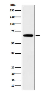 Anti-IGF2BP2 Rabbit Monoclonal Antibody Boster Bio