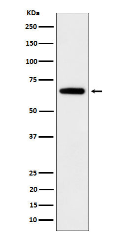 Anti-IGF2BP2 Rabbit Monoclonal Antibody Boster Bio