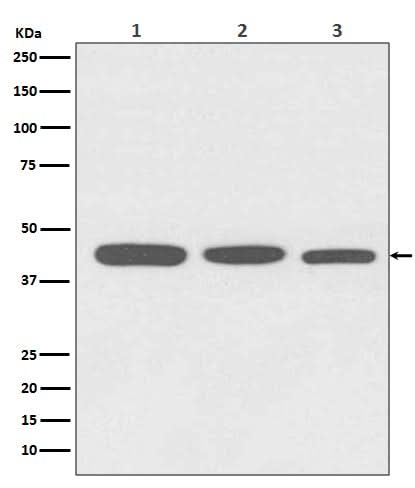Anti-Actin ACTA1 Rabbit Monoclonal Antibody Boster Bio