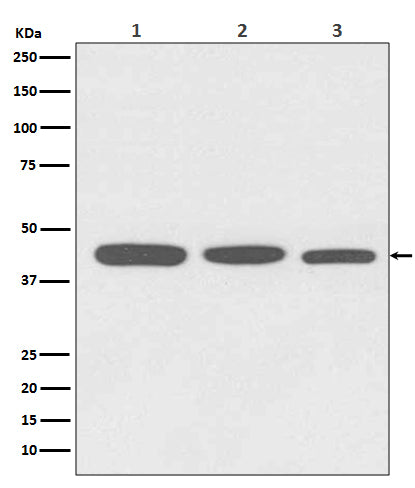 Anti-Actin ACTA1 Rabbit Monoclonal Antibody Boster Bio