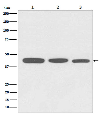 Anti-Actin ACTA1 Rabbit Monoclonal Antibody Boster Bio