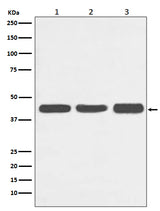 Anti-Actin ACTA1 Rabbit Monoclonal Antibody Boster Bio