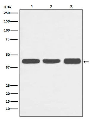 Anti-Actin ACTA1 Rabbit Monoclonal Antibody Boster Bio