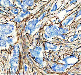 Anti-Actin (Alpha-Actin) ACTA1 Rabbit Monoclonal Antibody Boster Bio