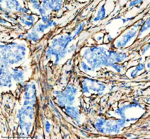 Anti-Actin (Alpha-Actin) ACTA1 Rabbit Monoclonal Antibody Boster Bio