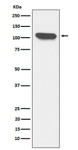 Anti-ERAP1 Rabbit Monoclonal Antibody Boster Bio