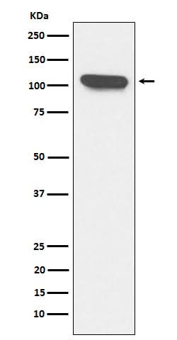 Anti-ERAP1 Rabbit Monoclonal Antibody Boster Bio