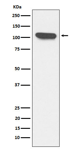 Anti-ERAP1 Rabbit Monoclonal Antibody Boster Bio