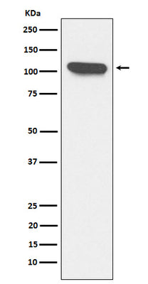 Anti-ERAP1 Rabbit Monoclonal Antibody Boster Bio