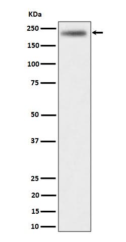 Anti-DENN Rabbit Monoclonal Antibody Boster Bio