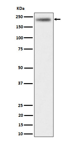 Anti-DENN Rabbit Monoclonal Antibody Boster Bio